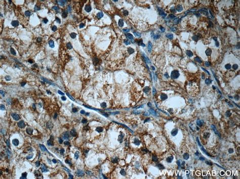 FAM92A1 antibody (24803-1-AP) | Proteintech
