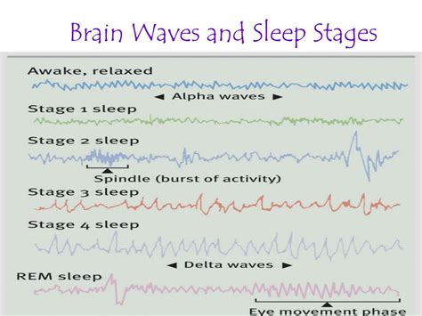 Sleep 的图像结果