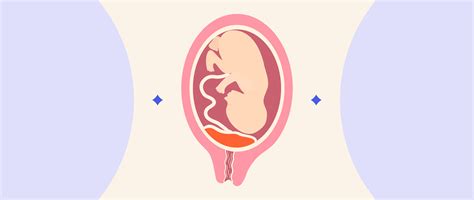 Placenta Praevia: Why Does It Happen During Pregnancy?