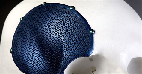 Medical Device Stacking Design 的图像结果