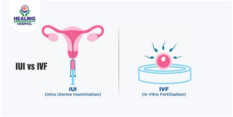 IUI vs IVF - Healing Hospital