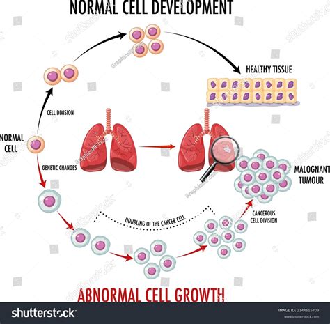 Image result for Cancer Development Cartoon