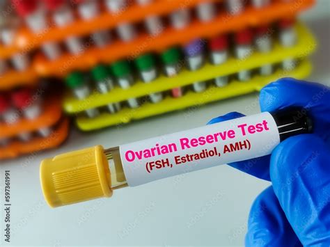 Image result for Ovary Function Test