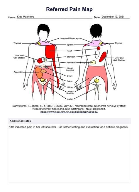 Referred Pain Map & Example | Free PDF Download