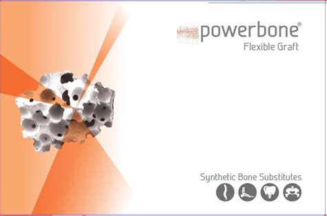 Image result for Flex Bone Matrix