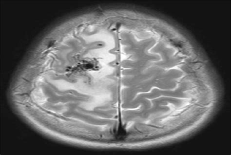 Neuro And Spine Surgery | Neuro Spine & Gynae Clinic