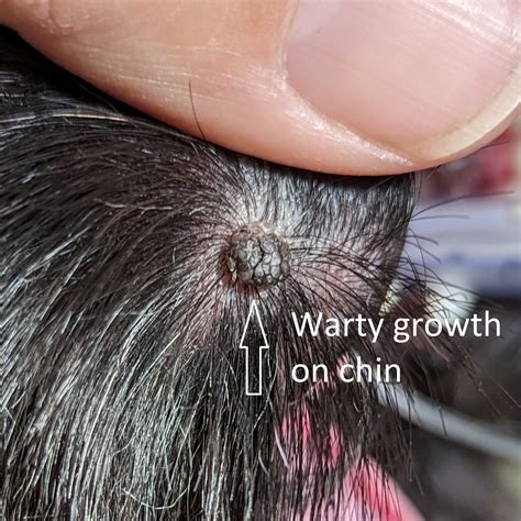 Do Dog Warts Come Back at Timothy Simpson blog