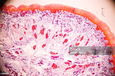 Image result for Finger Under Microscope