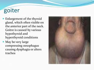 Image result for Thyroid Function Algorithm