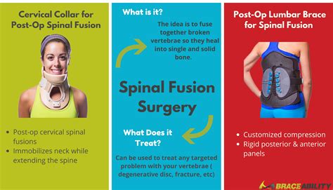 Post-Op Braces after Back Surgery, Fusion, Laminectomy