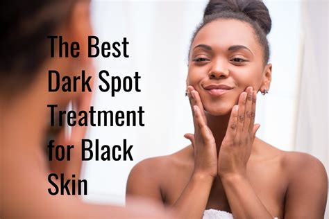 Dark Spot Corrector For Black Skin - Carotone Black Spot Corrector ...