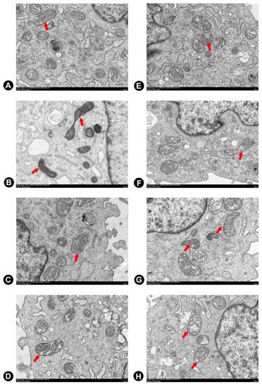 Flavonoids from Hippophae rhamnoides Linn. Revert Doxorubicin-Induced ...
