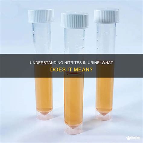 Understanding Nitrites In Urine: What Does It Mean? | MedShun