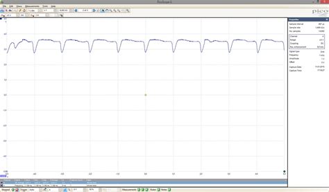 Image result for Arduino PPG