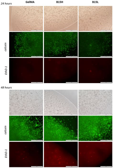 Characterization of a Chimeric Resilin-Elastin Structural Protein ...