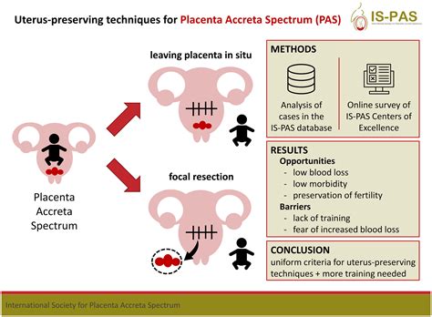International Society for Placenta Accreta Spectrum Evidence‐based updates: Acta Obstetricia et ...