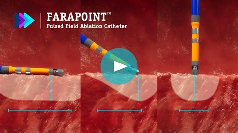 FARAPOINT™ Pulsed Field Ablation Catheter - Boston Scientific