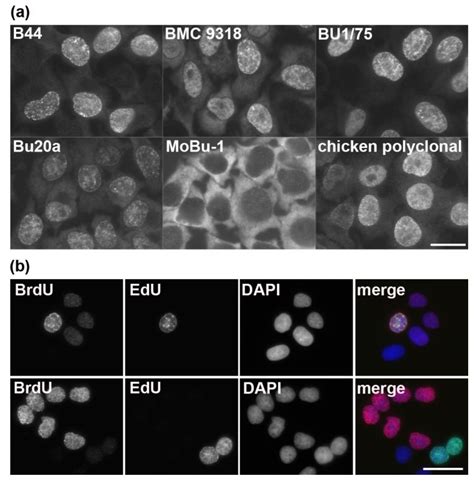 DNA Replication: From Radioisotopes to Click Chemistry