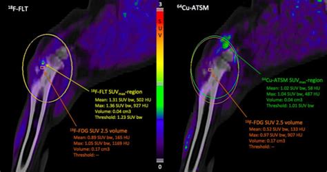 Use of Molecular Imaging Markers of Glycolysis, Hypoxia and ...