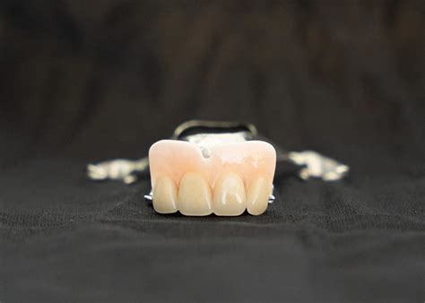 Image result for Front Teeth Partials Options