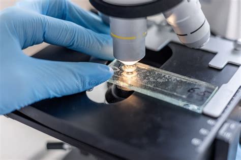 Image result for Tissue Sample Test