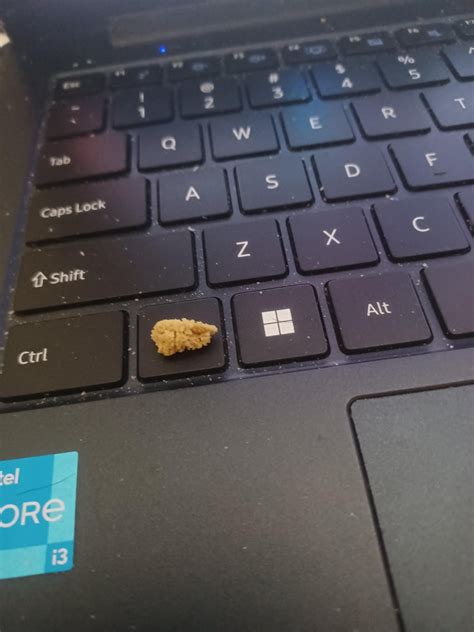 3rd Kidney Stone : r/KidneyStones