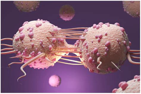 Computer-Aided Early Melanoma Brain-Tumor Detection Using Deep-Learning ...