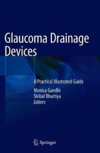 Glaucoma Drainage Devices: Buy Glaucoma Drainage Devices by unknown at ...