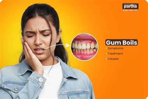 Gum Boils: Symptoms, Treatment, Causes & Cost. - Partha Dental Hair
