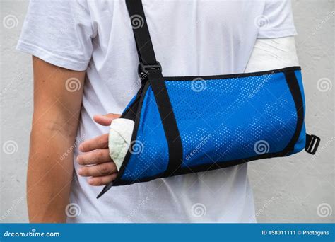 Man with Broken Arm Wrapped Medical Cast Plaster and Blue Bandage ...