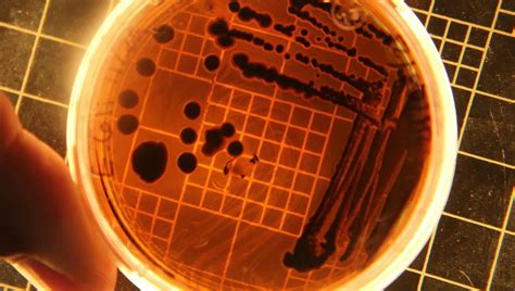 Buknula epidemija salmonele, deseci djece u bolnicama - Dnevnik.in