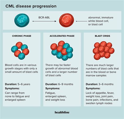 Blast Crisis Phase in Chronic Myeloid Leukemia (CML)