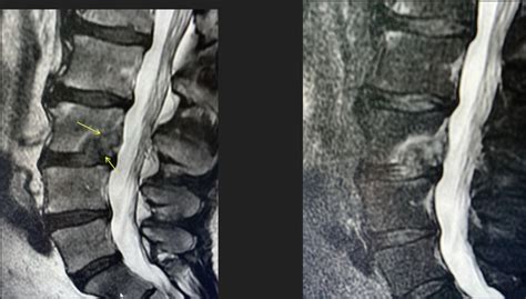 Image result for Alien Head THCA