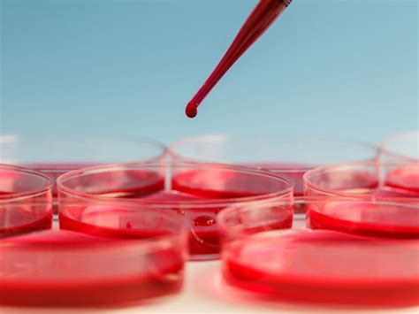 Image result for Coombs Test