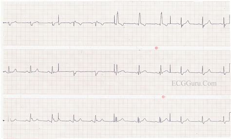 LPFB | ECG Guru - Instructor Resources