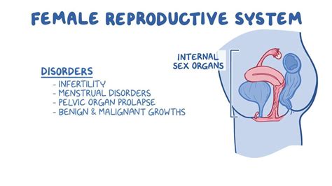 Reproductive System Disorders 的图像结果