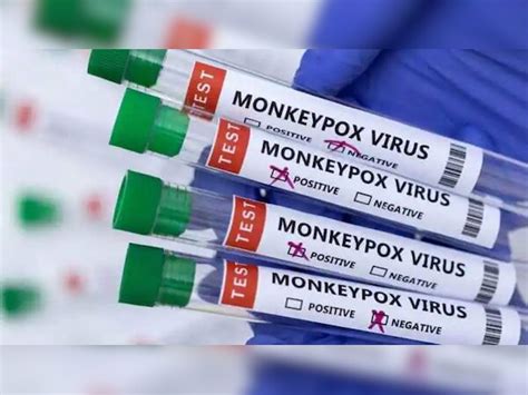 monkeypox detected in children in us virus latest news | Monkeypox से ...