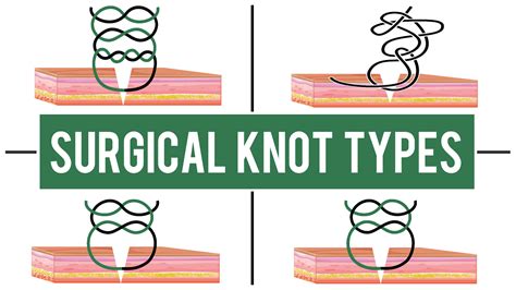 Types Of Surgical Knot at Lachlan Legge blog