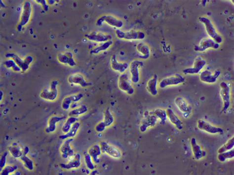 Brain-Destroying Amoeba Rattles Louisiana Parish: What You Should Know - NBC News
