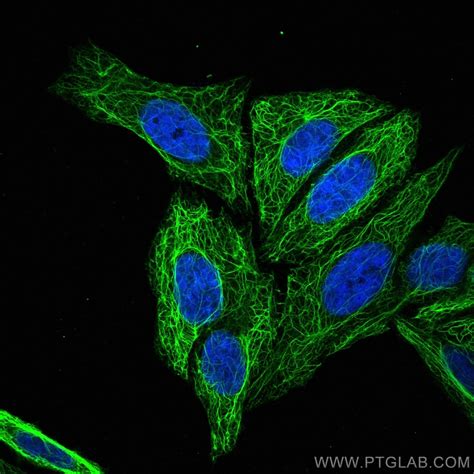 Cytokeratin 17-Specific antibody (17516-1-AP) | Proteintech