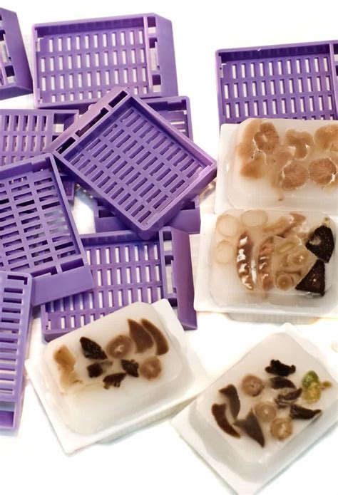 Image result for Caustic Tissue Sample