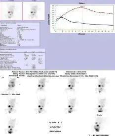 Hydronephrosis : Symptoms, Causes and Diagnosis