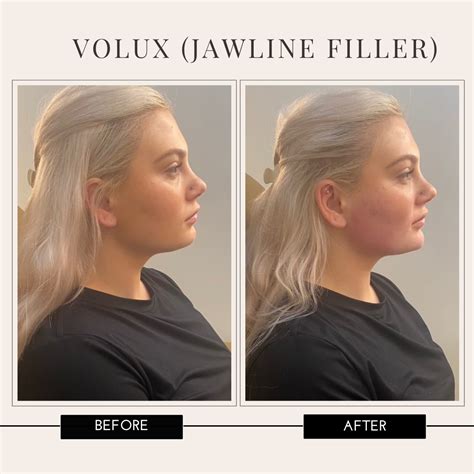 What is Jawline Contouring? - Boss Gal Beauty Bar