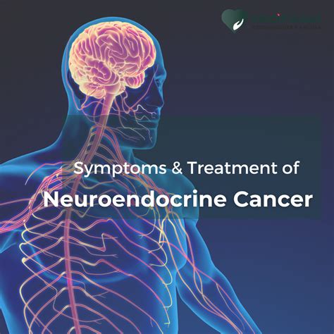 What is Neuroendocrine Cancer? Symptoms & Treatment