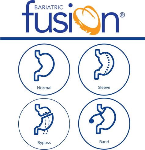 Buy Bariatric Fusion Complete Chewable Bariatric Multivitamin with Iron ...