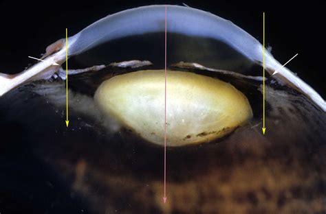 Angle Recession 的图像结果