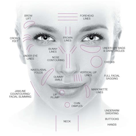 Nasolabial Fold Best Treatments For Nasolabial Folds And Marionette