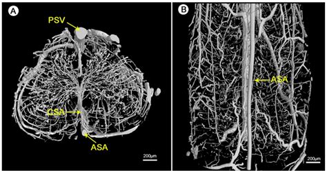Microvascular Tissue Engineering—A Review