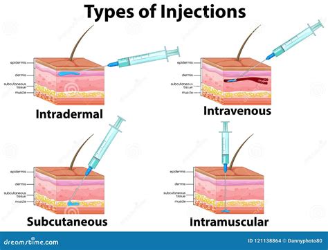 Image result for Subcutaneous vs Intradermal Mouse Injection