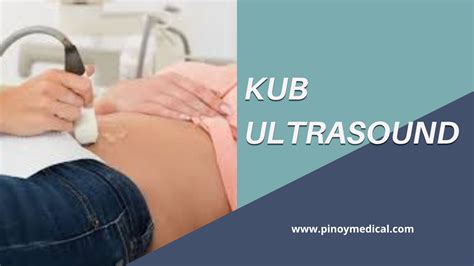 KUB Ultrasound Price in the Philippines 2026 — PinoyMedical